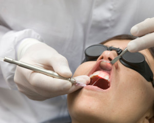 dental work performed with a laser