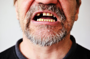Five Hidden Factors That Cause You To Lose Your Teeth