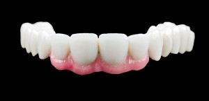 The Benefits Of Porcelain Veneers