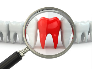 Your Heart’s Health And Periodontal Disease