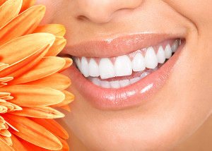 How Do I Care For My Teeth After Having Them Whitened?