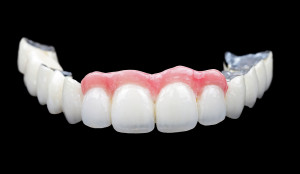 A Closer Look At Porcelain Veneers