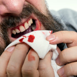 How Do You Know If You Have Gum Disease?