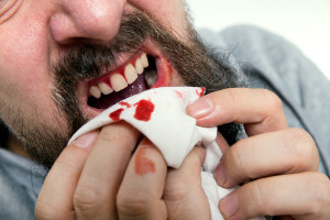 How Do You Know If You Have Gum Disease?