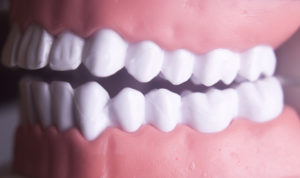 Gums Matter Just As Much As Teeth