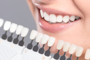 The Main Reasons To Consider Cosmetic Dentistry