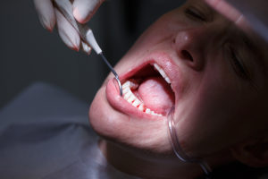 Diabetics Need Extra Dental Care