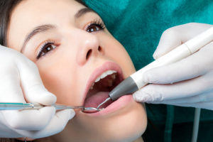 The Importance Of Regular Dental Cleaning 