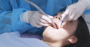  Professional Teeth Cleaning Can Improve Your Life In These Ways