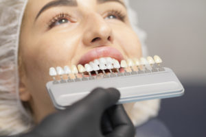 Things To Think About When Considering Dental Implants