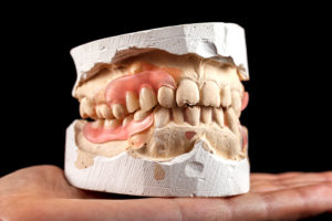 Are Same Day Dentures In Your Best Interest?