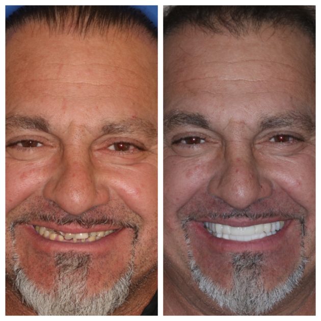 Cosmetic Dentistry before and after