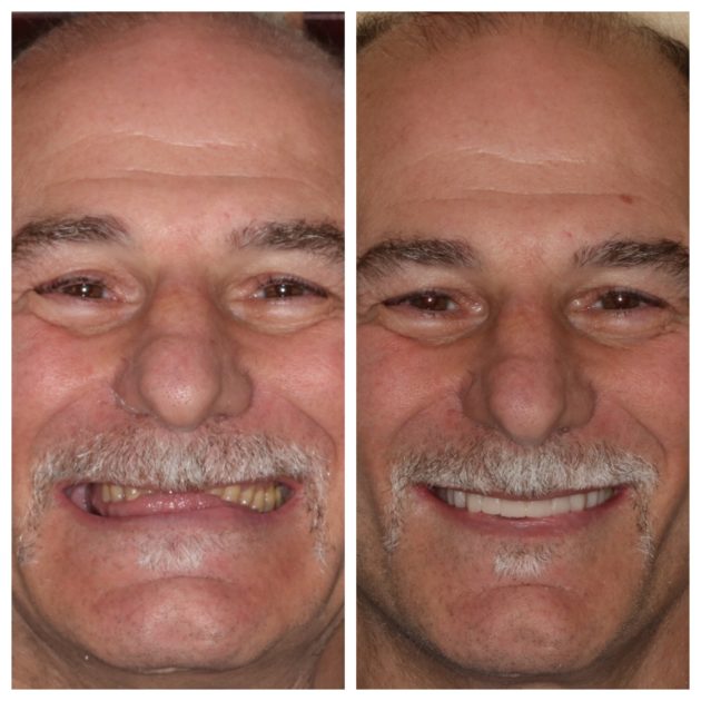 Cosmetic Dentistry before and after
