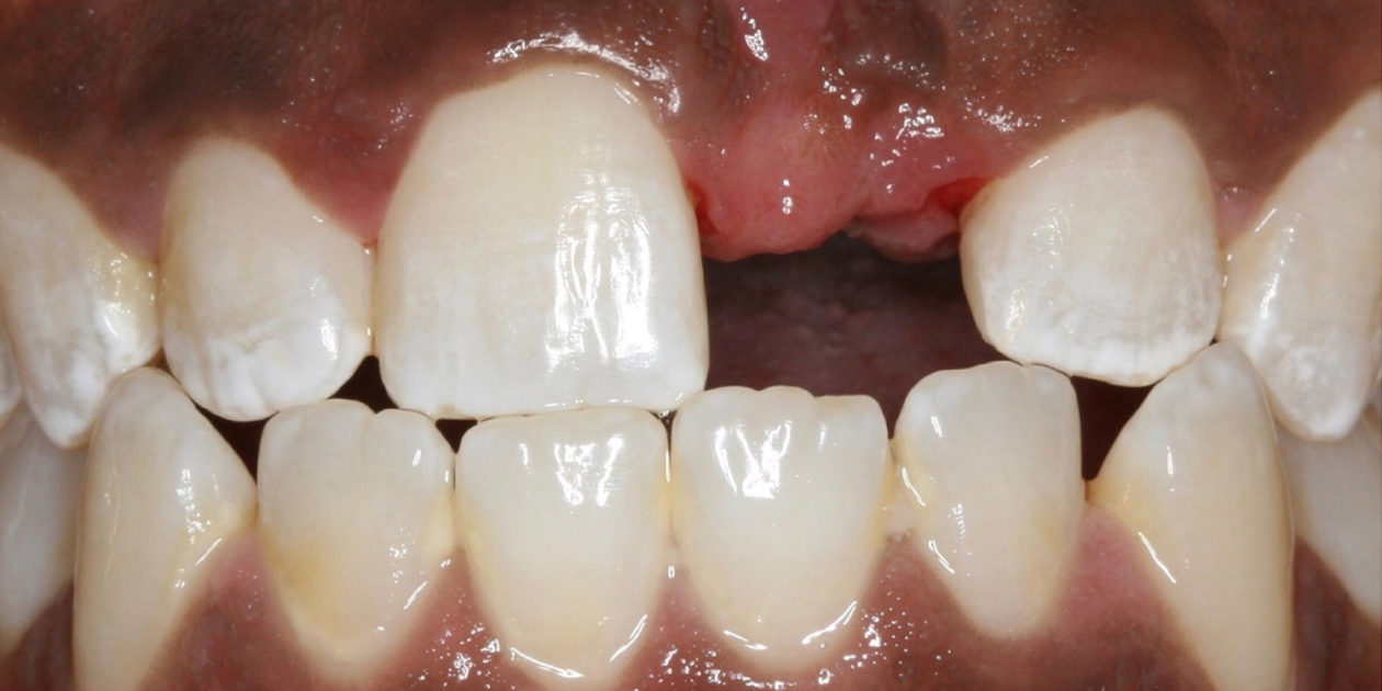 case 41 - before