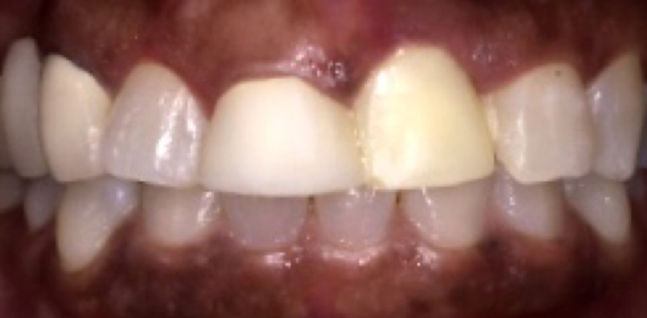 case 14 - before