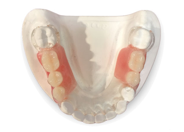 partial upper and lower dentures