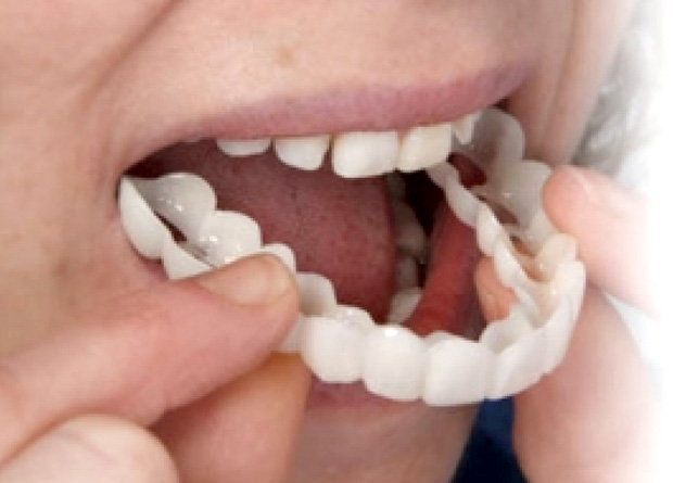 woman putting on snap on dentures