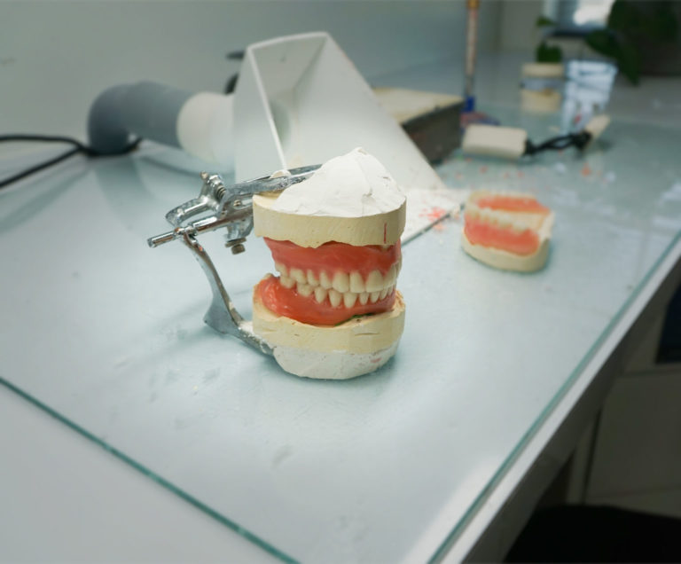 Custom fit Dentures and Implants
