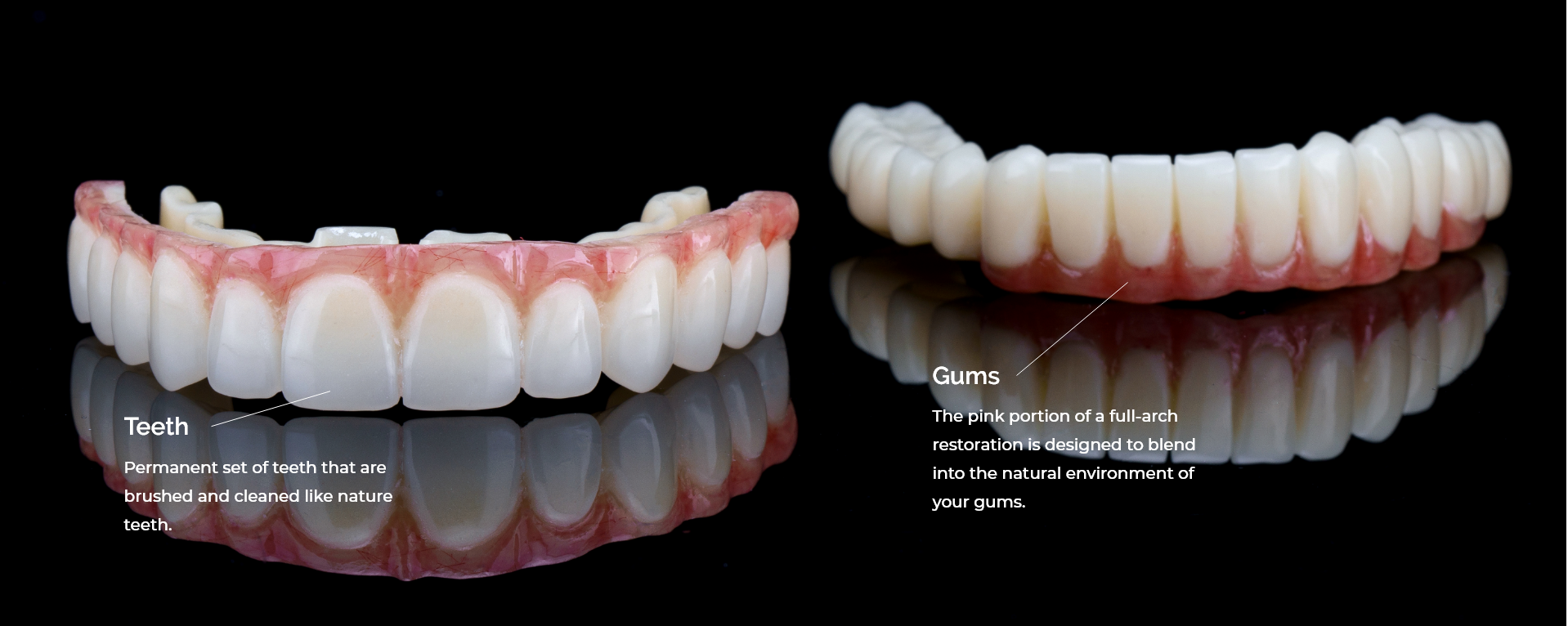 Upper and bottom teeth replacement showing the gums and teeth