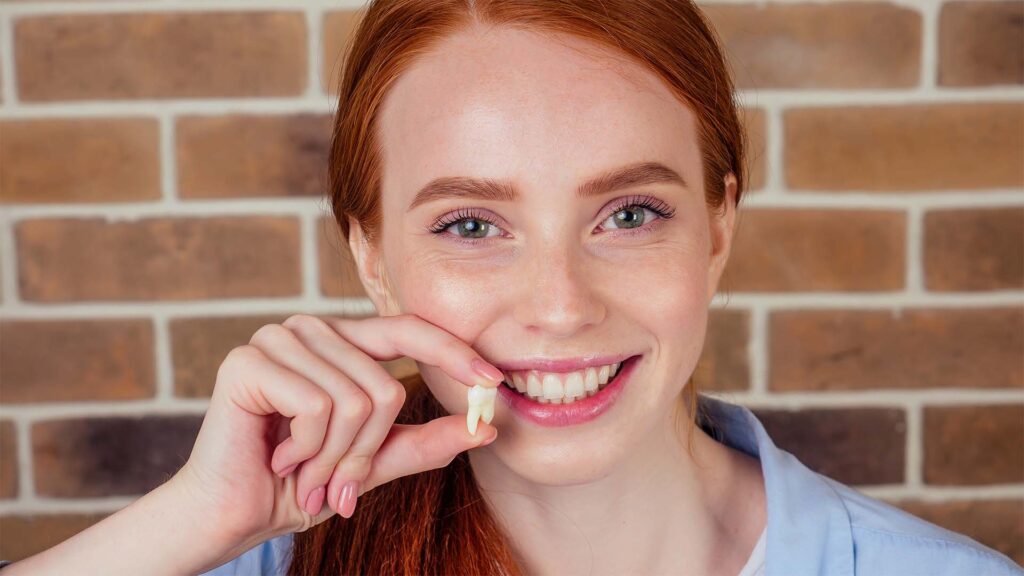 wisdom teeth removal at Shine Dental Associates