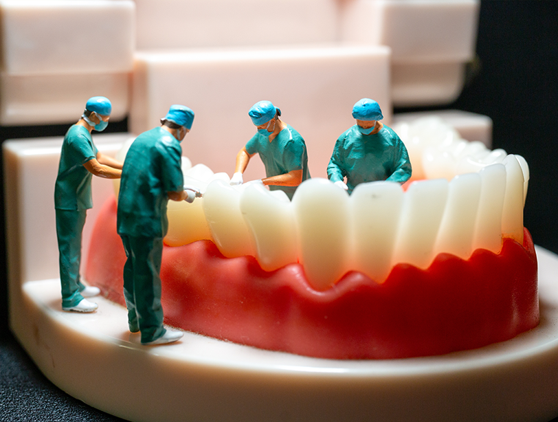 Dental Implant Maintenance