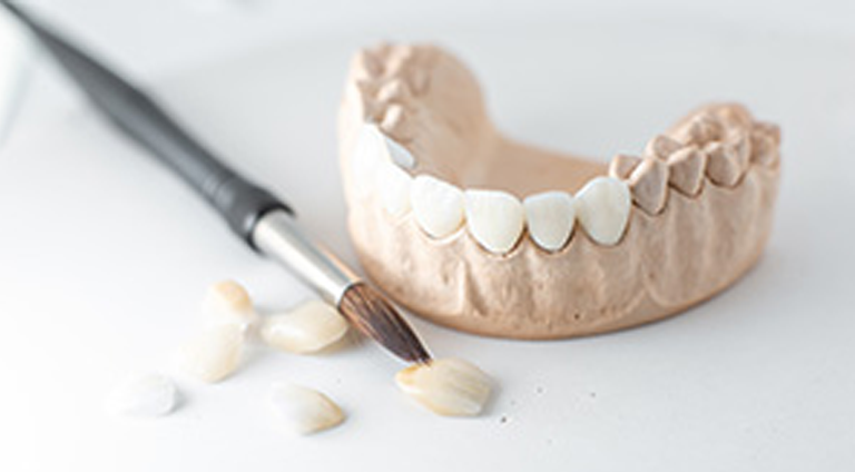 Custom dental crown created to match natural tooth shape and color