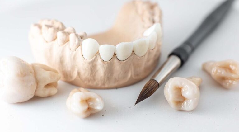 Dental crown treatment option for restoring missing or damaged teeth in Syosset, NY