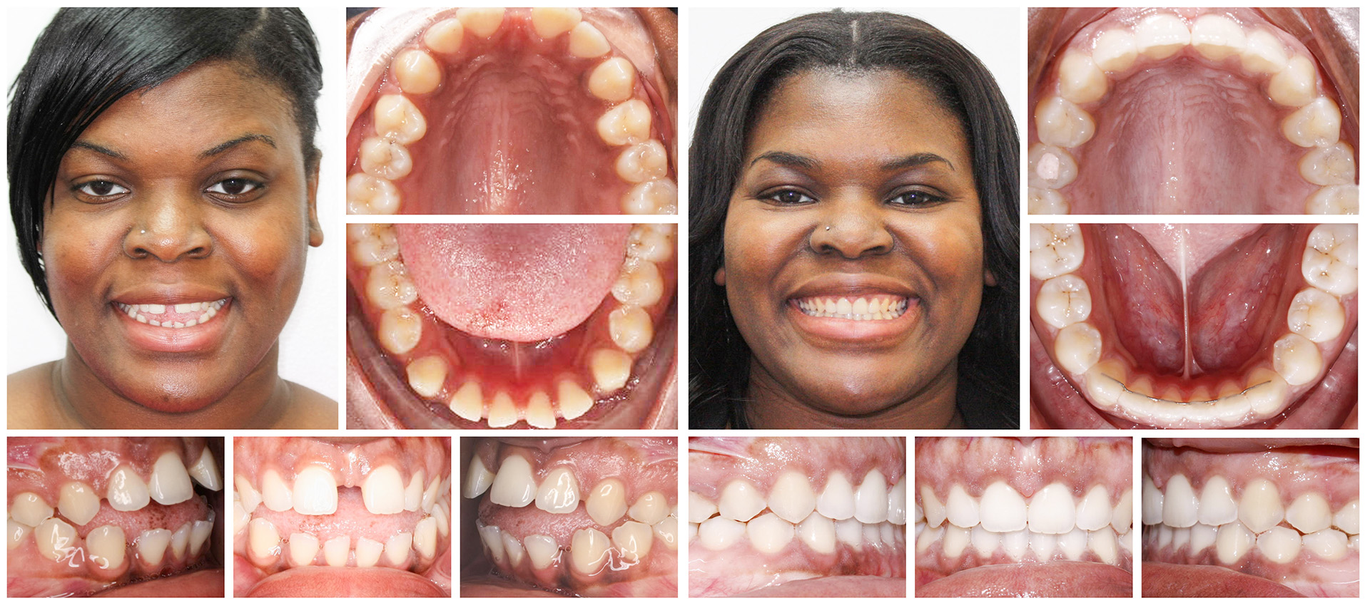 Woman2-composite_11_11_2024_3_40_47_PM